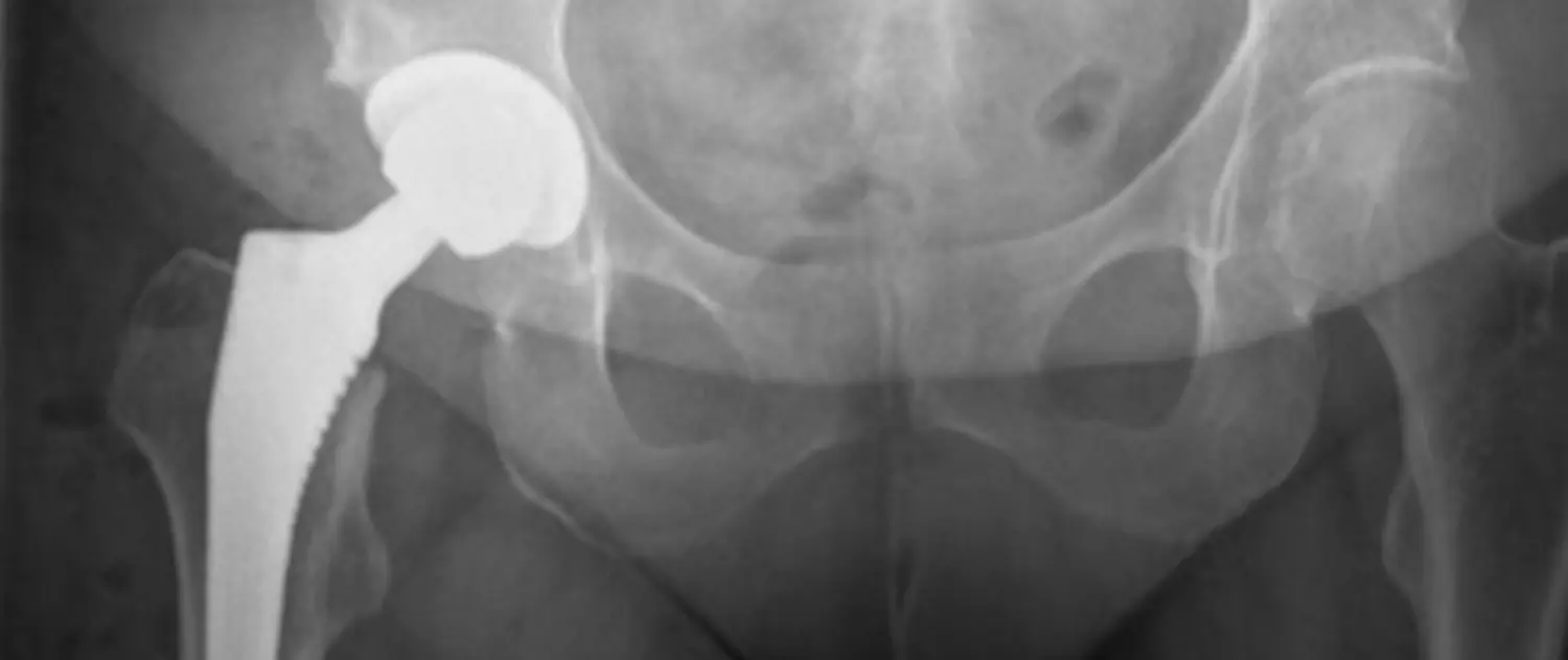 Dr. Tareq Soumma Cum Laude - Orthopäde für Hüfte