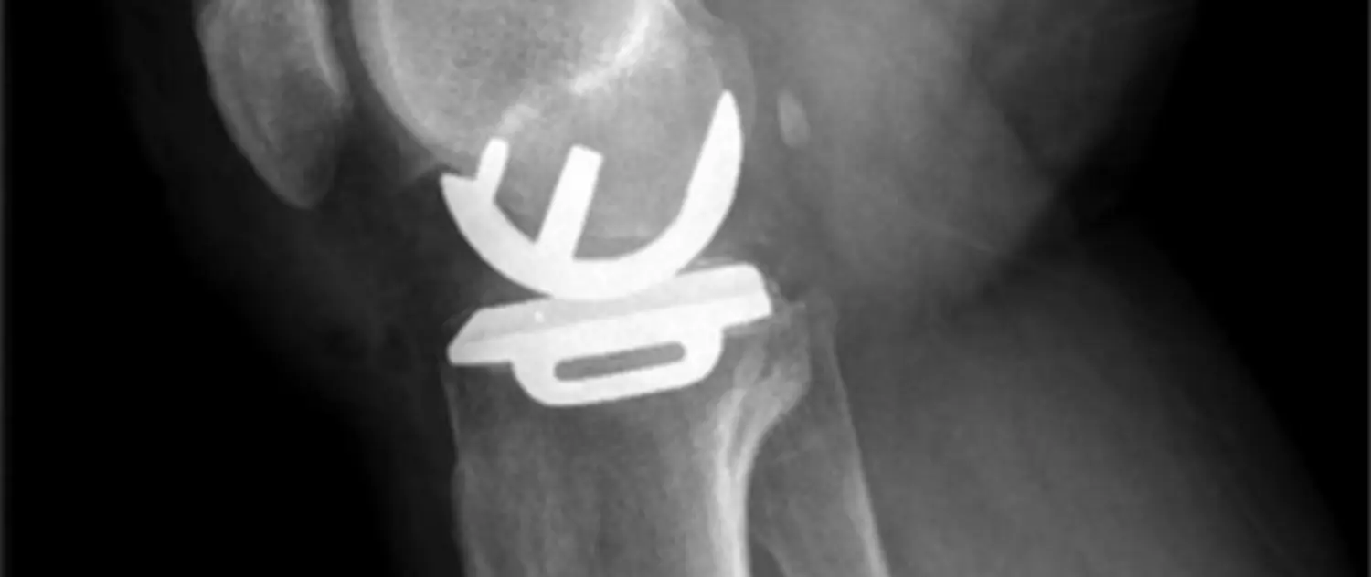 Dr. Tareq Soumma Cum Laude - Orthopäde für Hüfte