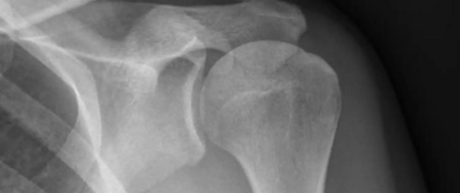 Dr. Tareq Soumma Cum Laude - Orthopäde für Hüfte