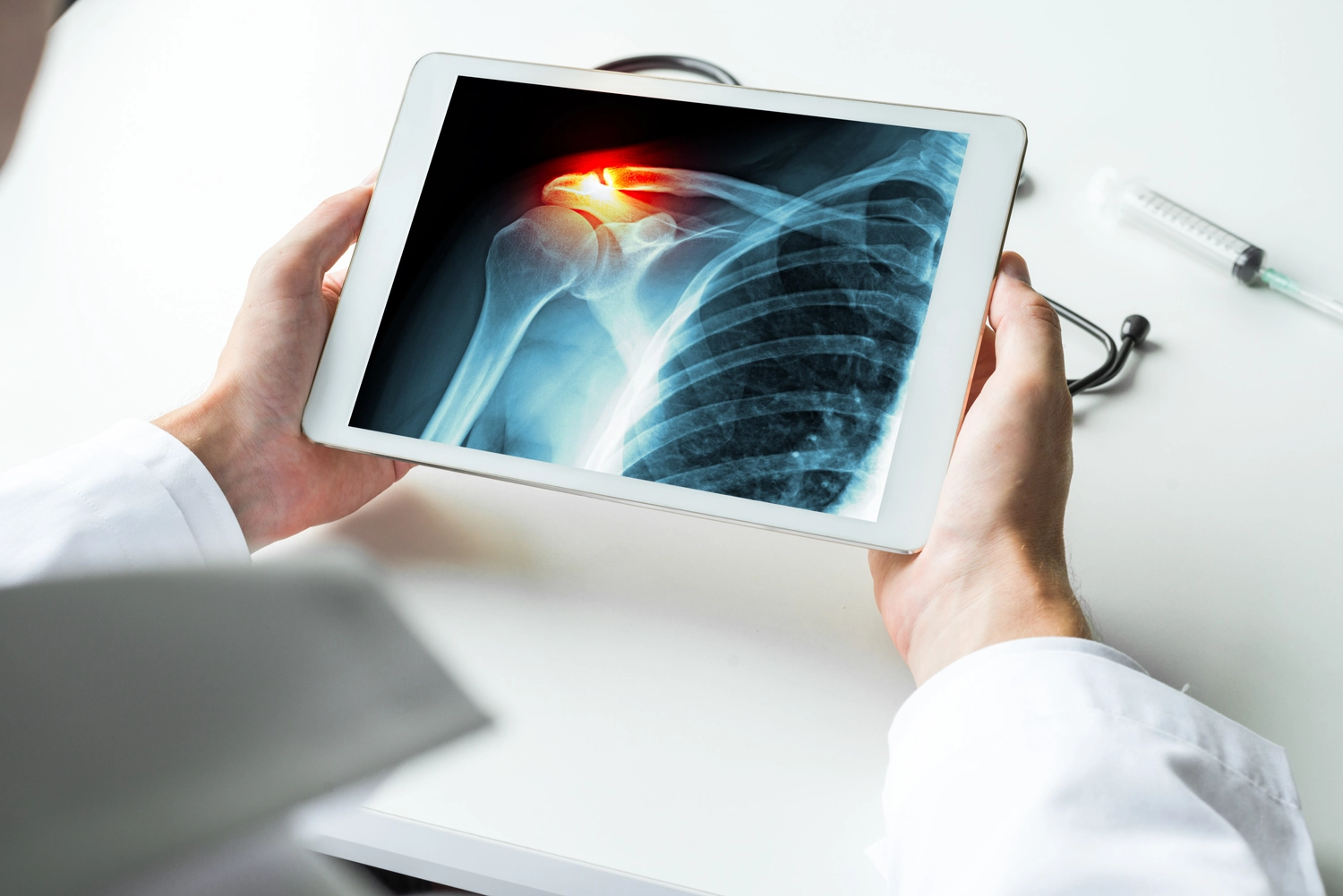 Dr. Tareq Soumma Cum Laude – Orthopäde für Hüfte – Arzt beobachtet eine Röntgenaufnahme einer gebrochenen Schulter mit Schmerzen auf einem digitalen Tablet. Radiologiekonzept